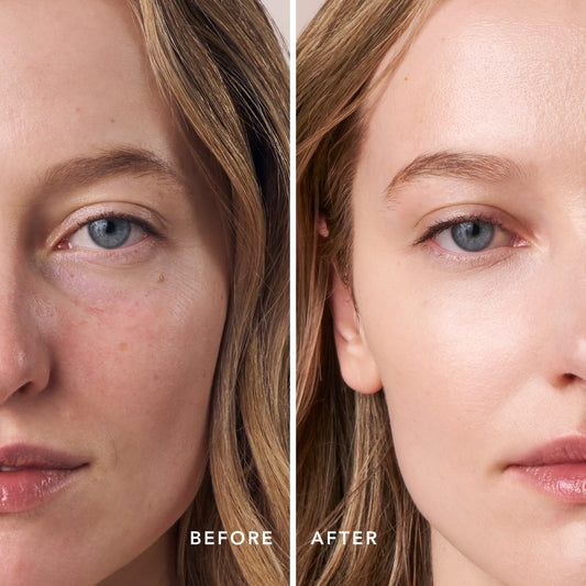 files/PDP_FutureSkin_Before_After_LIGHT.jpg